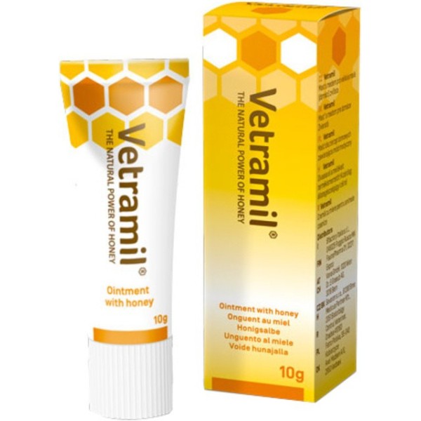 Vetramil tepalas